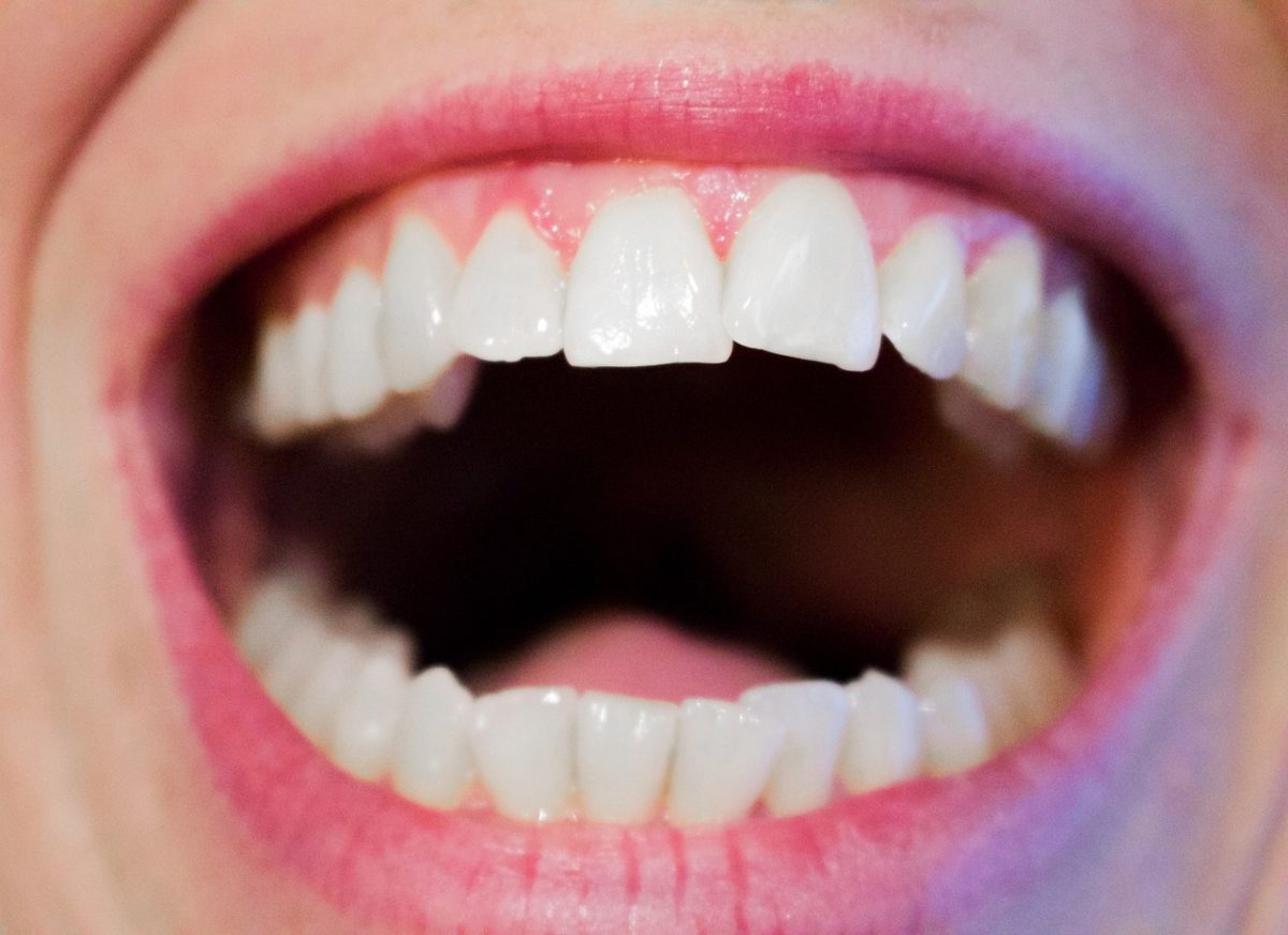 Nowoczesna technika używana w salonach stomatologii estetycznej być może spowodować, że odzyskamy śliczny uśmiech.